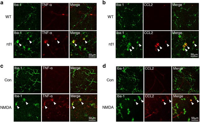 necroptosis in microglia contributes to neuroinflammation glial cell