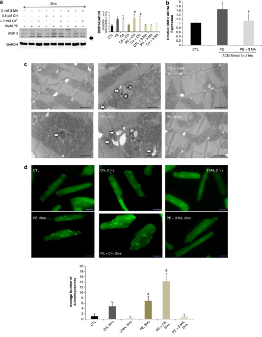 Jnk modulates foxo3a for the expression of the mitochondrial death and mitophagy marker bnip3 in pathological hypertrophy and in heart failure
