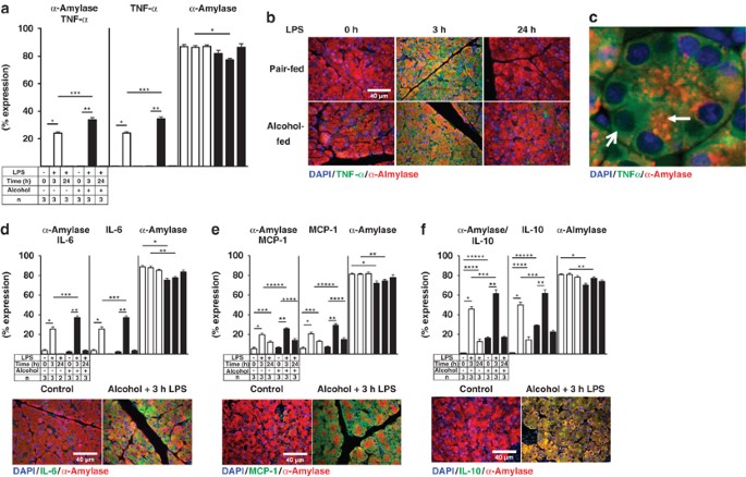 Necro Inflammatory Response Of Pancreatic Acinar Cells In The Pathogenesis Of Acute Alcoholic Pancreatitis Cell Death Disease