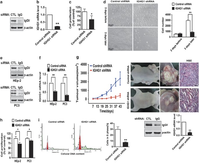 Cancer-derived immunoglobulin G promotes tumor cell growth and  proliferation through inducing production of reactive oxygen species | Cell  Death & Disease