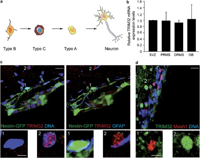 TRIM32-dependent transcription in adult neural progenitor cells regulates  neuronal differentiation | Cell Death & Disease