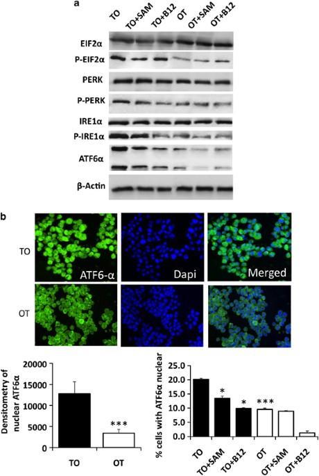 Decreased vitamin B12 availability induces ER stress through 
