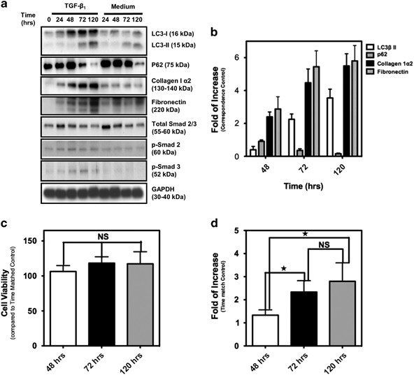 Autophagy Is A Regulator Of Tgf B 1 Induced Fibrogenesis In Primary Human Atrial Myofibroblasts Cell Death Disease