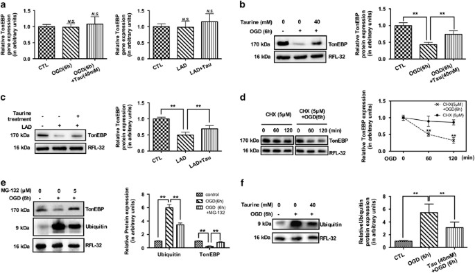 Tonebp Modulates The Protective Effect Of Taurine In Ischemia Induced Cytotoxicity In Cardiomyocytes Cell Death Disease