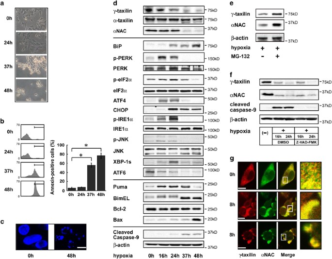 Gsk 3 B Dependent Downregulation Of G Taxilin And A Nac Merge To Regulate Er Stress Responses Cell Death Disease Gsk 3 B Dependent Downregulation Of G Taxilin And A Nac Merge To Regulate Er Stress Responses Cell Death Disease