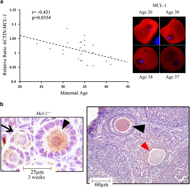 Mcl-1 is a key regulator of the ovarian reserve