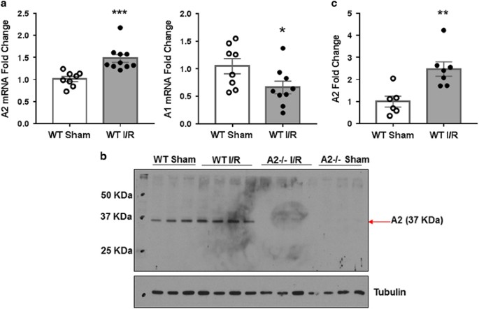 Arginase 2 promotes neurovascular degeneration during ischemia/reperfusion injury