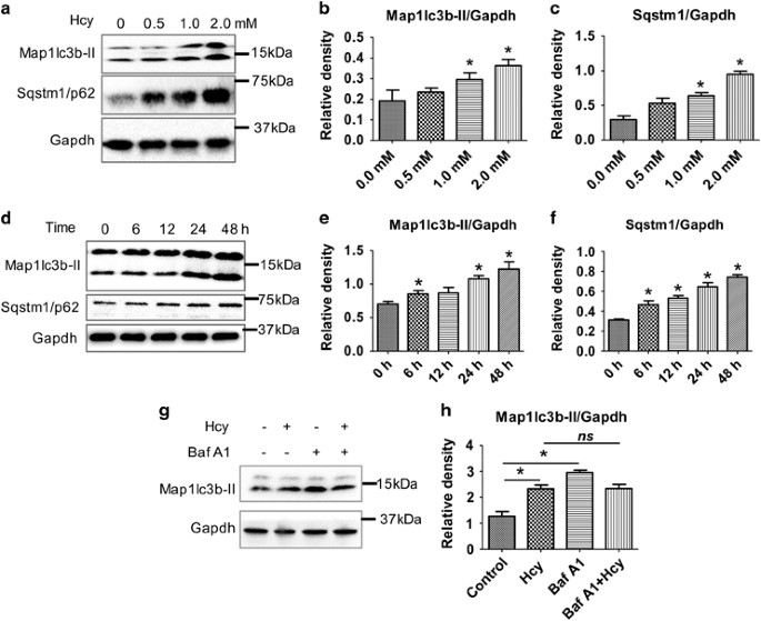 Hyperhomocysteinemia causes ER stress and impaired autophagy that 