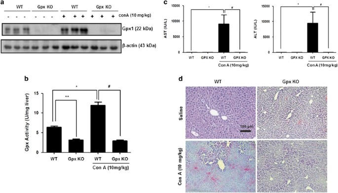 Glutathione peroxidase 1 deficiency attenuates concanavalin A-induced hepatic injury by modulation of T-cell activation | Cell Death & Disease Glutathione peroxidase 1 deficiency attenuates concanavalin A-induced hepatic injury by modulation of T-cell activation | Cell Death & Disease