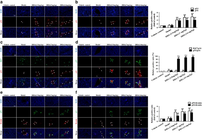 Interaction between autophagy and senescence is required for dihydroartemisinin to alleviate liver fibrosis