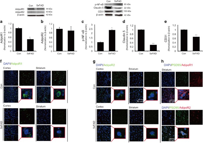 Adiponectin Controls The Apoptosis And The Expression Of Tight Junction Proteins In Brain Endothelial Cells Through Adipor1 Under Beta Amyloid Toxicity Cell Death Disease