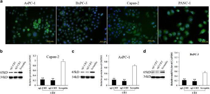 Calreticulin Promotes Egf Induced Emt In Pancreatic Cancer Cells Via Integrin Egfr Erk Mapk Signaling Pathway Cell Death Disease