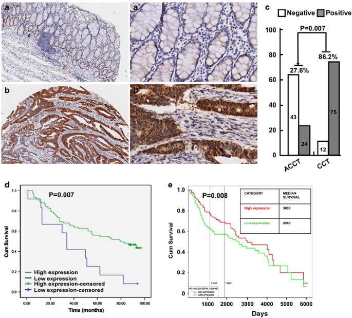 NCAPH plays important roles in human colon cancer