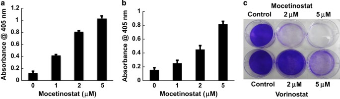 Class i hdac inhibitor mocetinostat induces apoptosis by activation of mir-31 expression and suppression of e2f6