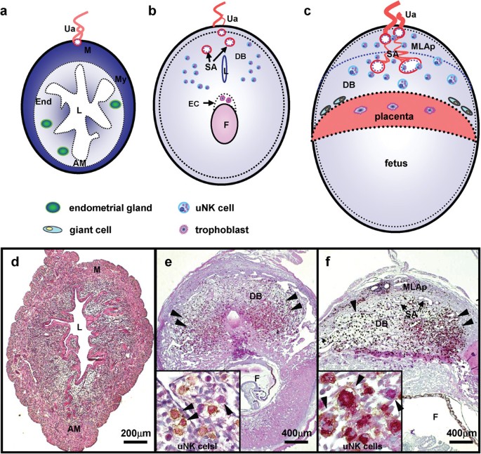 Natural killer cell-triggered vascular transformation: maternal care before  birth? | Cellular & Molecular Immunology