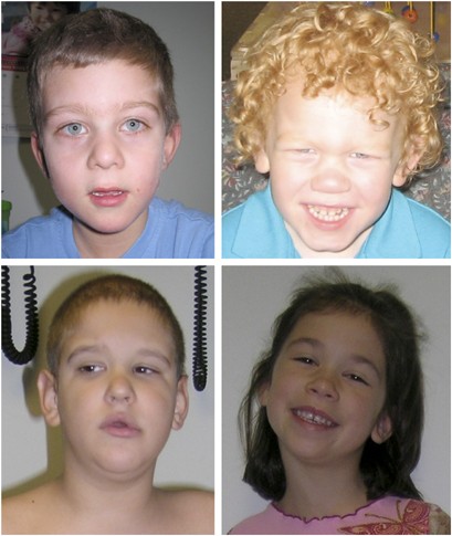 Fragile X syndrome | European Journal of Human Genetics