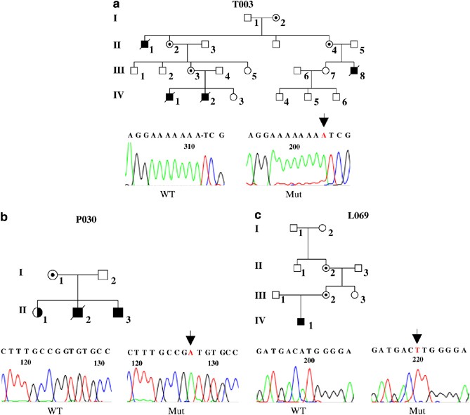 Mct8 Mutation Analysis And Identification Of The First Female With Allan Herndon Dudley Syndrome Due To Loss Of Mct8 Expression European Journal Of Human Genetics