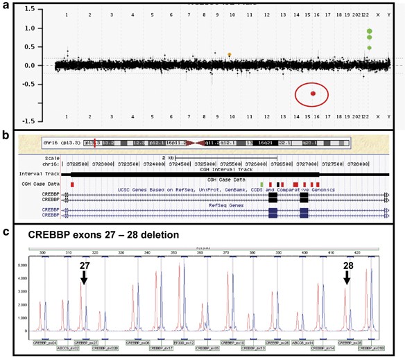 Genetic heterogeneity in Rubinstein–Taybi syndrome: delineation of the  phenotype of the first patients carrying mutations in EP300