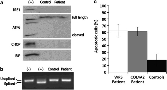 (PDF) Identification of de novo EP300 and PLAU variants in a patient with  Rubinstein–Taybi syndrome-related arterial vasculopathy and skeletal anomaly