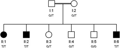Mutation of fibulin-1 causes a novel syndrome involving the central nervous system and connective tissues