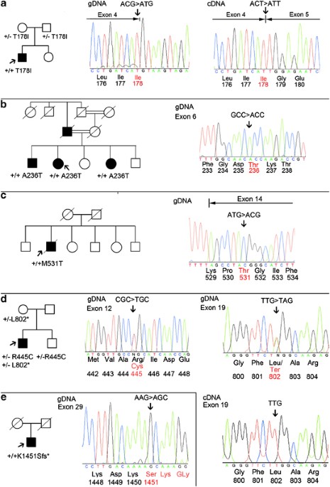Recessive Myosin Myopathy With External Ophthalmoplegia Associated With Myh2 Mutations European Journal Of Human Genetics