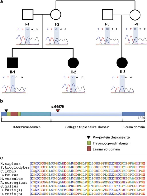 (PDF) Identification of de novo EP300 and PLAU variants in a patient with Rubinstein–Taybi syndrome-related arterial vasculopathy and skeletal anomaly