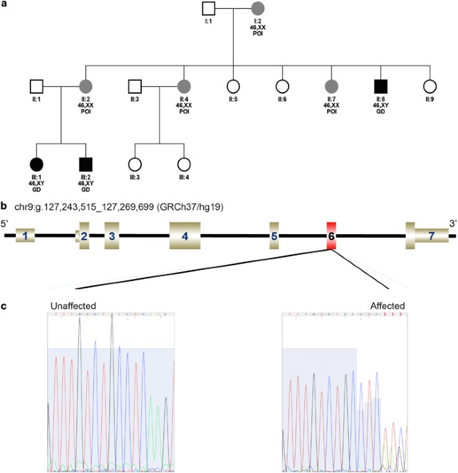 Whole exome sequencing combined with linkage analysis identifies a novel 3  bp deletion in NR5A1 | European Journal of Human Genetics