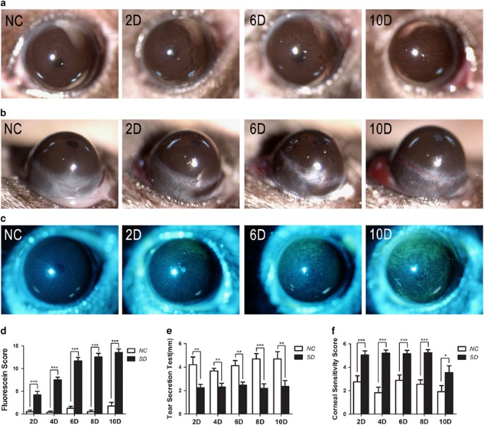 Sleep deprivation disrupts the lacrimal system and induces dry eye disease  | Experimental & Molecular Medicine