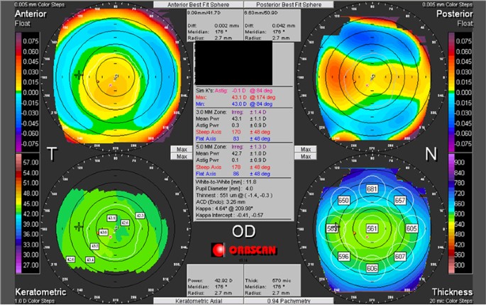 Pachymetry Chart