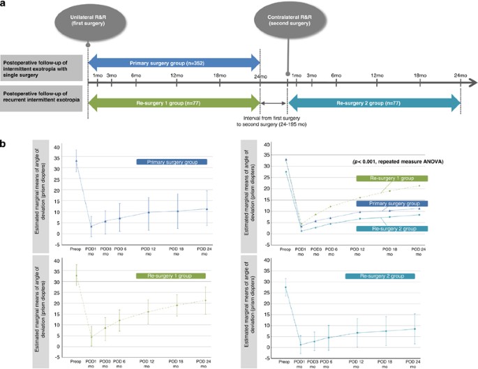 The Clinical Course Of Recurrent Intermittent Exotropia Following One Or Two Surgeries Over 24 Months Postoperatively Eye
