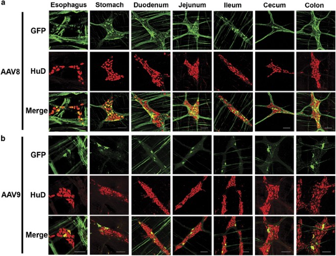 Systemic Gene Delivery Transduces The Enteric Nervous System Of Guinea Pigs And Cynomolgus Macaques Gene Therapy