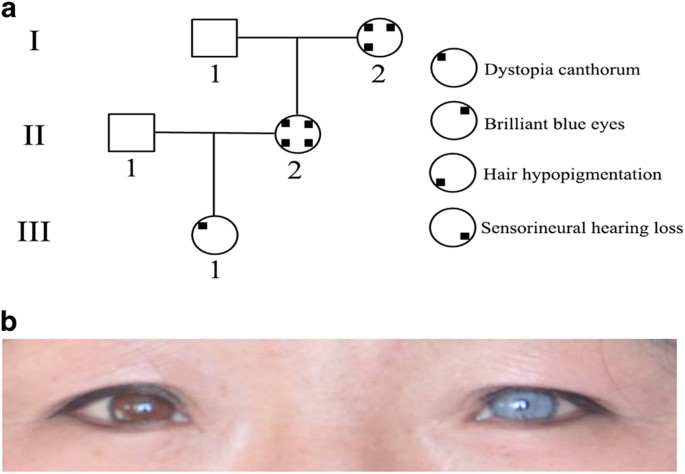 Whole Exome Sequencing Analysis Of Waardenburg Syndrome In A Chinese Family Human Genome Variation