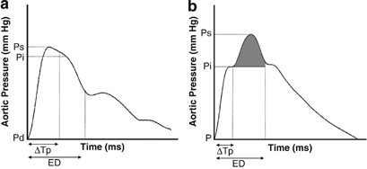 Pulse wave velocity analysis