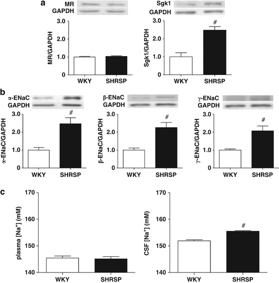 Mineralocorticoid receptors/epithelial na+ channels in the choroid plexus are involved in hypertensive mechanisms in stroke-prone spontaneously hypert