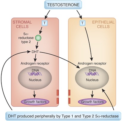 does testosterone cause prostate enlargement