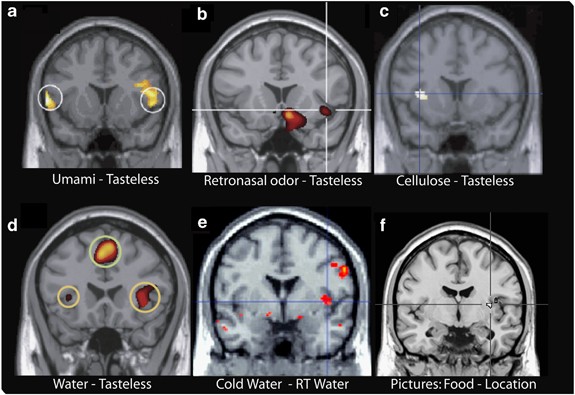 The gustatory cortex and multisensory integration | International Journal  of Obesity