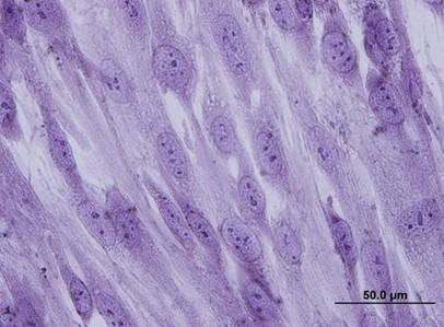 Cord lining progenitor cells: potential in vitro adipogenesis model
