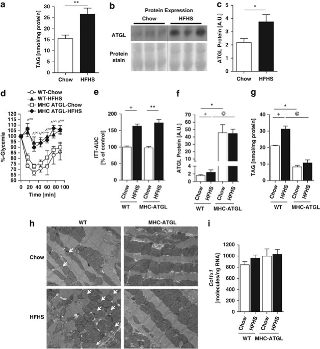 diet induced dilated cardiomyopathy