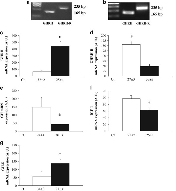 Growth hormone-releasing hormone is produced by adipocytes and regulates  lipolysis through growth hormone receptor | International Journal of Obesity