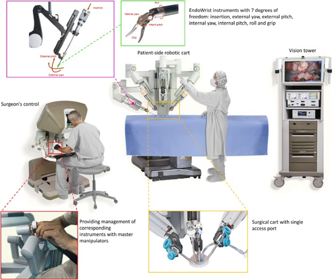 Robotic surgical systems in maxillofacial surgery: a review | International  Journal of Oral Science