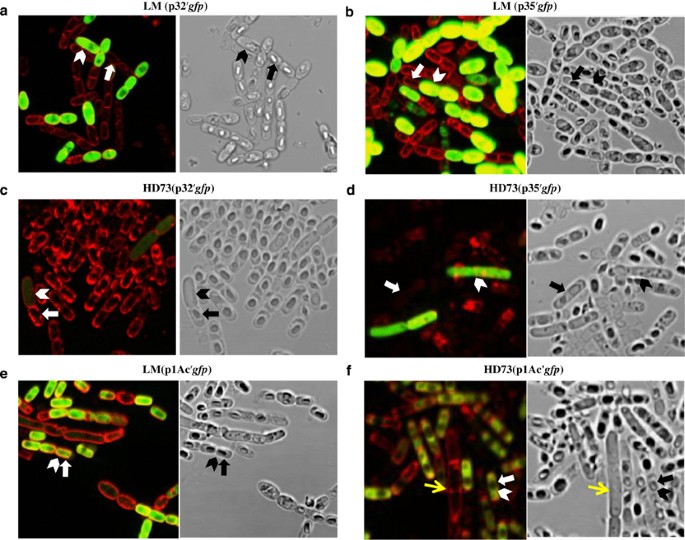 Sporulation in Bacillus thuringiensis Berliner. a The standard stages