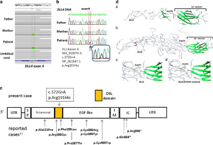 PDF) Identification of de novo EP300 and PLAU variants in a patient with  Rubinstein–Taybi syndrome-related arterial vasculopathy and skeletal anomaly