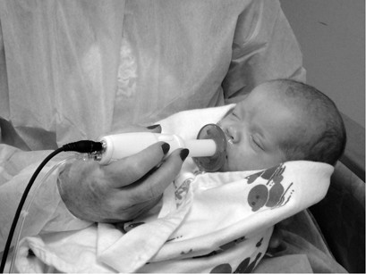 child med soothie pacifier