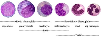 Comparing Automated Vs Manual Leukocyte Differential Counts For Quantifying The Left Shift In The Blood Of Neonates Journal Of Perinatology