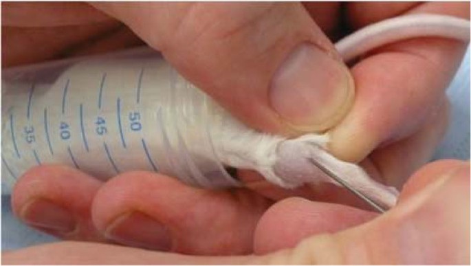 Effects of different blood collection methods on indicators of welfare in  mice | Lab Animal