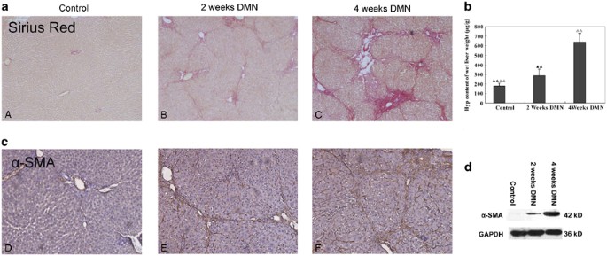 Kupffer Cells Are Associated With Apoptosis Inflammation And Fibrotic Effects In Hepatic Fibrosis In Rats Laboratory Investigation