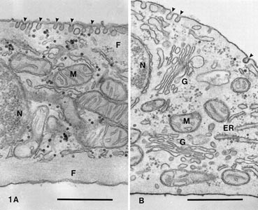 Differences In Caveolae Dynamics In Vascular Smooth Muscle Cells Of Different Phenotypes Laboratory Investigation