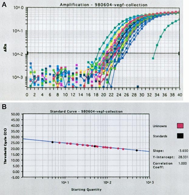 Quantification of vegf mrna expression in non-small cell lung cancer using a real-time quantitative reverse transcription-pcr assay and a comparison w