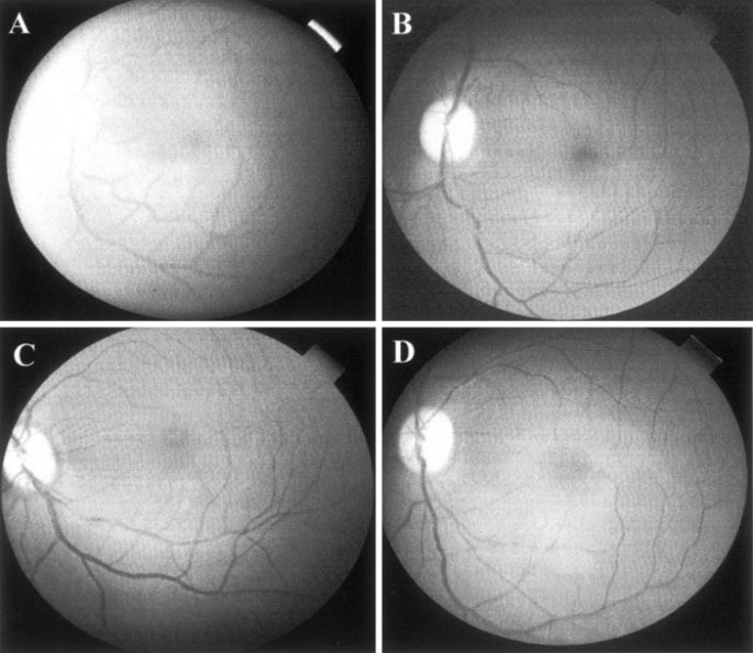 Preclinical evaluation of a phosphorothioate oligonucleotide in the retina of rhesus monkey