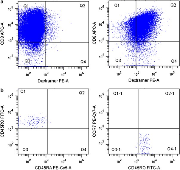 Natural t-cell responses against minor histocompatibility antigen (mhag) hy following hla-matched hematopoietic cell transplantation: what are the requirements for a ‘good’ mhag?